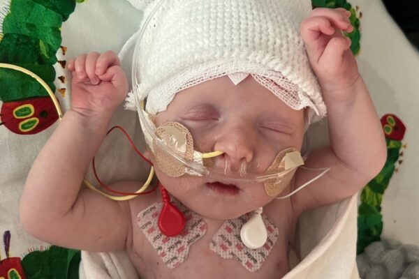 KJ was only days old when he was diagnosed with a rare metabolic disorder