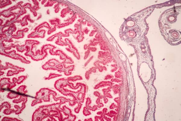 Histological Uterus: Human uterine tube. Placenta and umbilical cord under the microscope for education.
