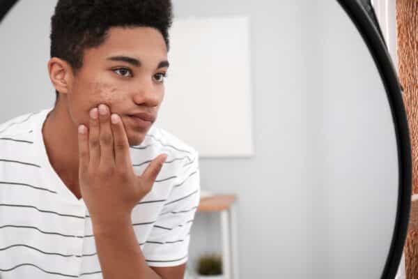 Teen examining pimples and acne in mirror