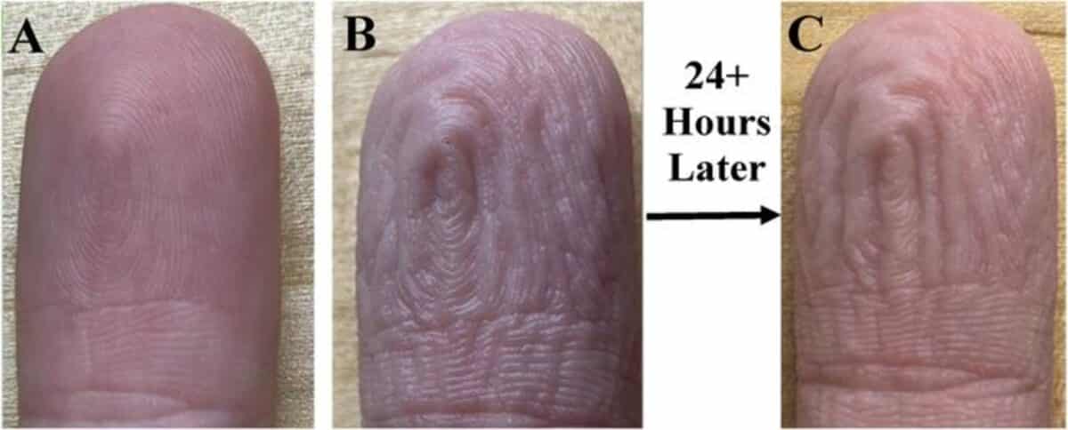 Pruney fingers