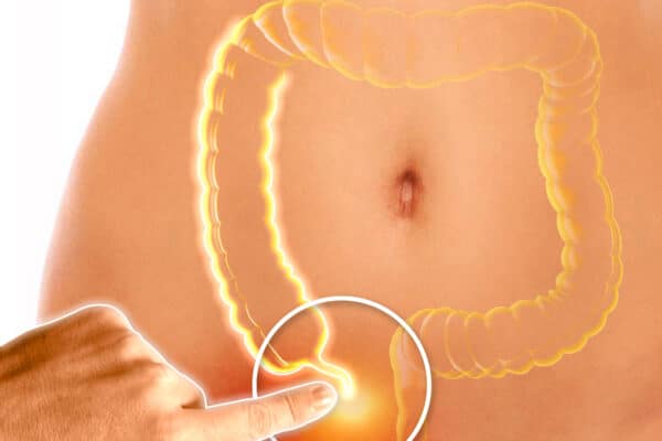 The appendix is a finger-like, blind-ended tube connected to the cecum. The cecum is a pouch-like structure of the colon.