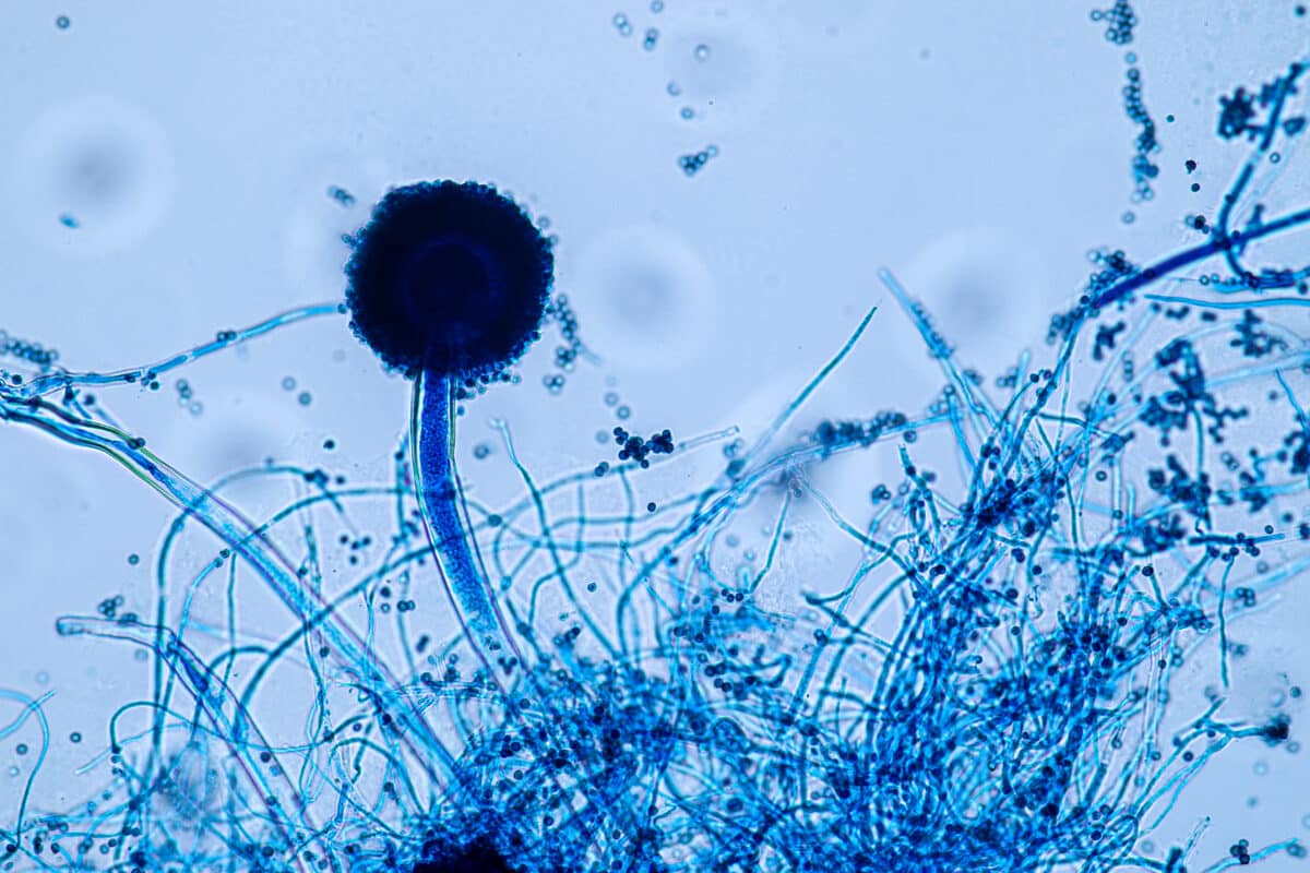 Aspergillus niger and Aspergillus oryzae (mold) under microscope
