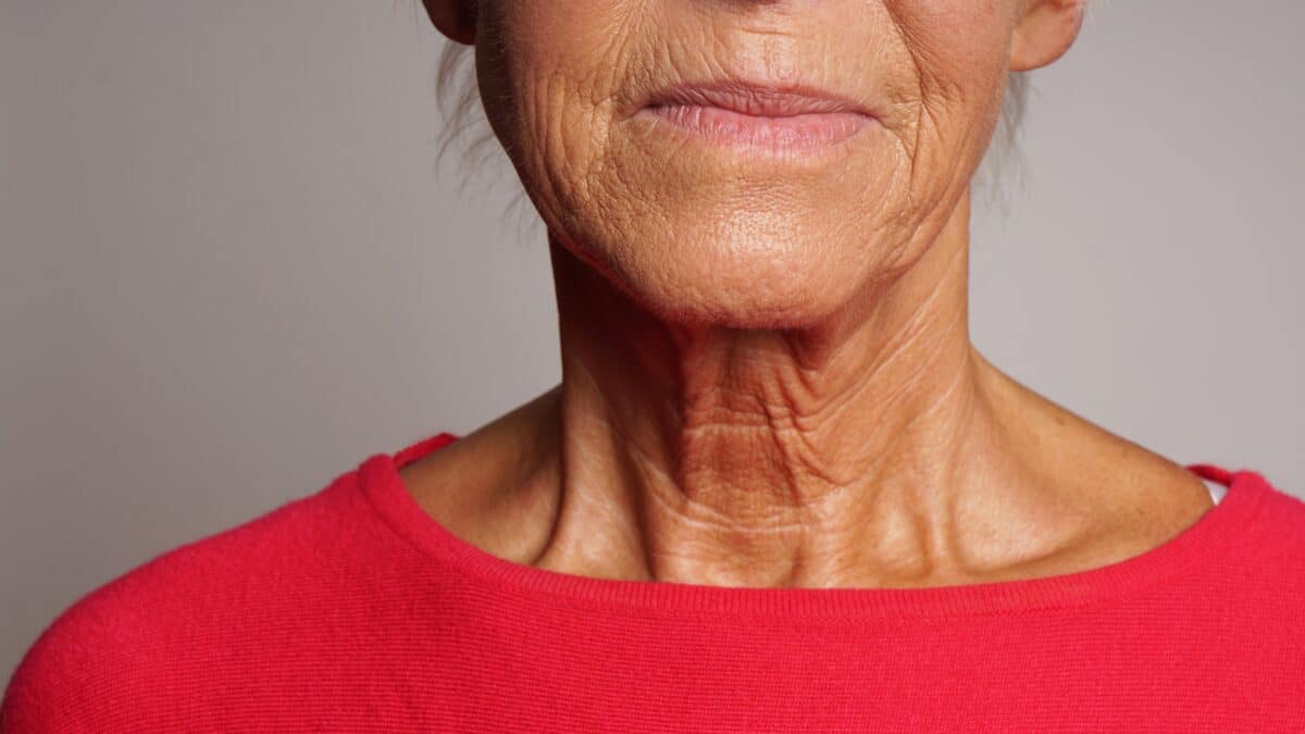 Wrinkles seen on an older woman's face and neck