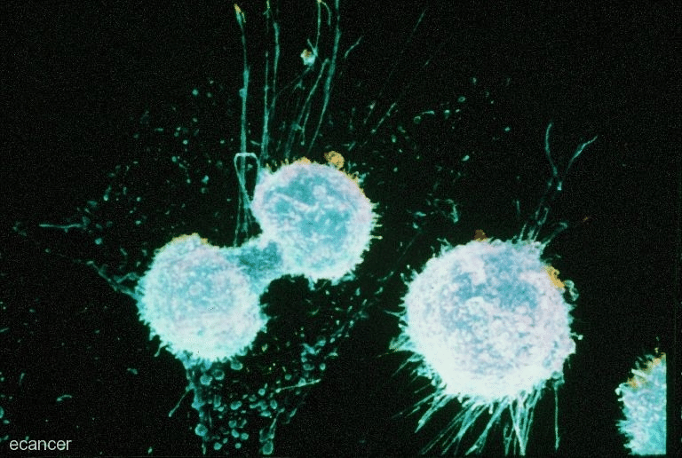 Ovarian cancer cells dividing