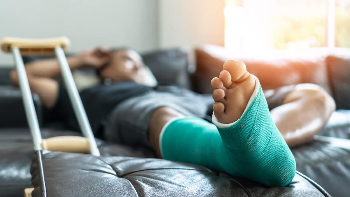 Broken leg
