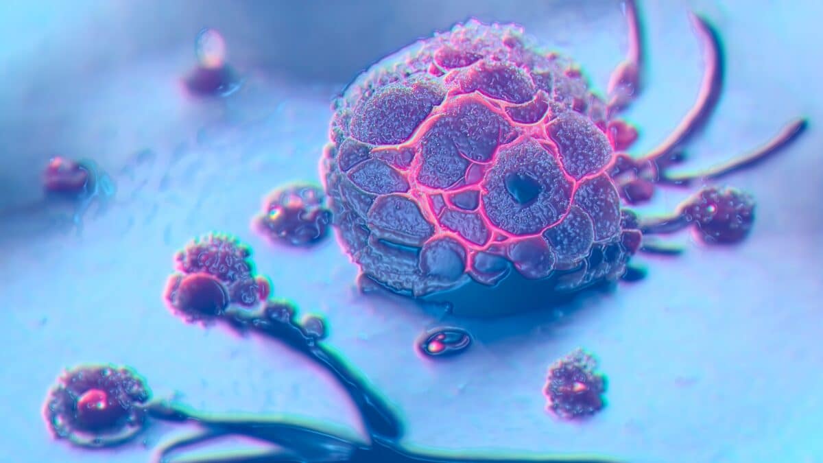 3D illustration depicting cancer cells and the growth of a tumor.