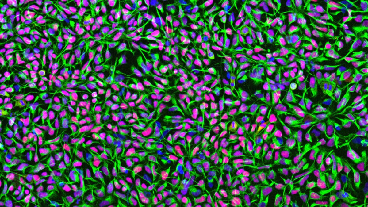 Human neural stem cells in culture.