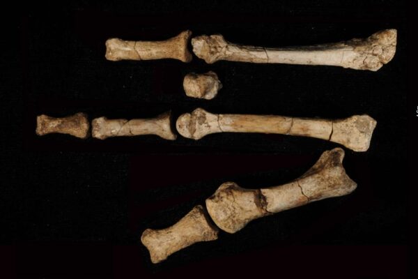 The Burtele Foot with its elements in the anatomical position.