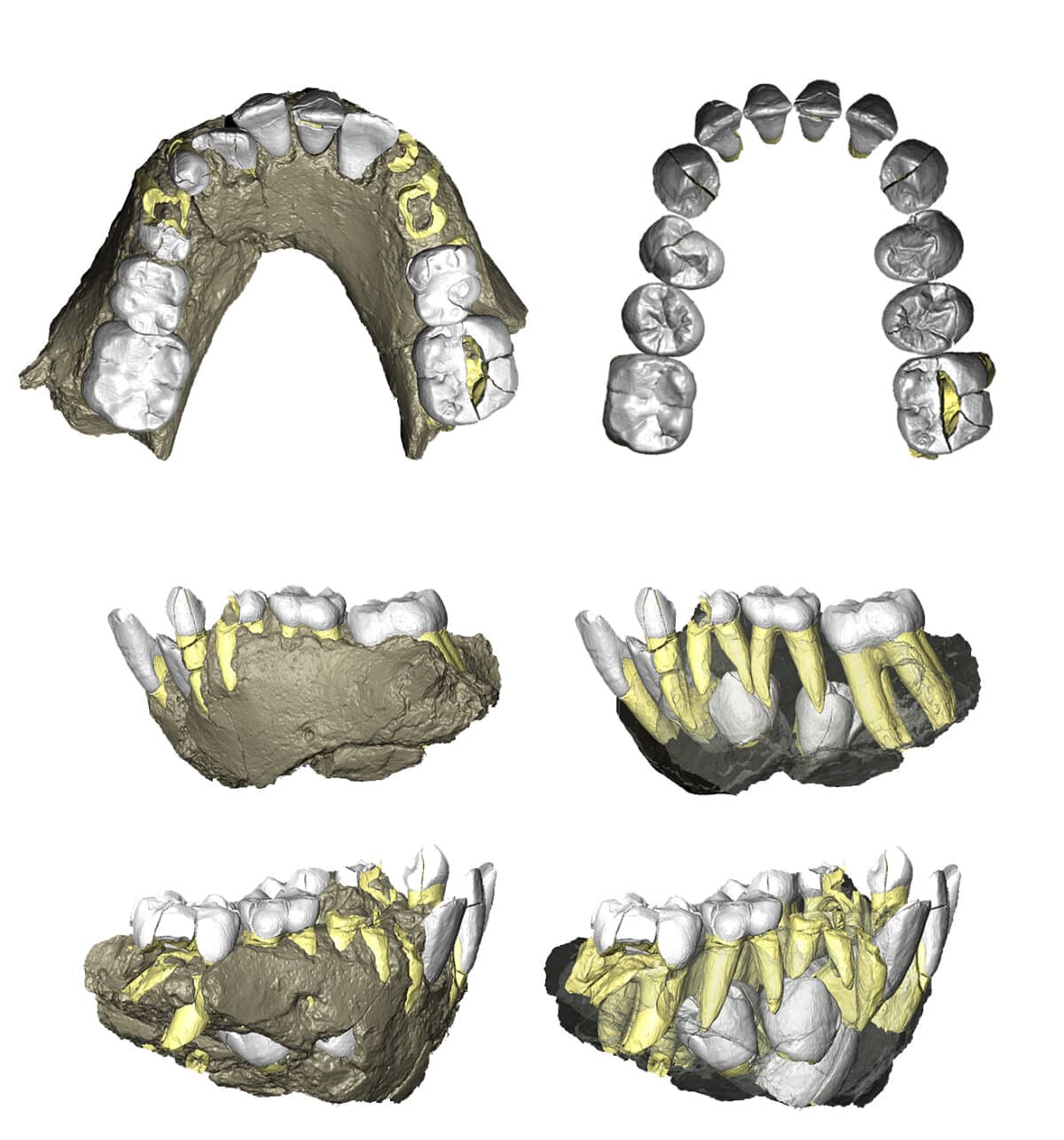 Juvenile mandible digital reconstruction from microCT scans. Images in the left column show the jaw’s external details, while images in the right column show the external bone rendered partly transparent to see the adult teeth developing away deep within the bony mandible.