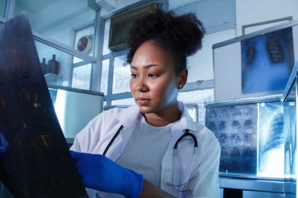 The AI is not intended to replace radiologists, but it can help them decide when a bronchoscopy is warranted.