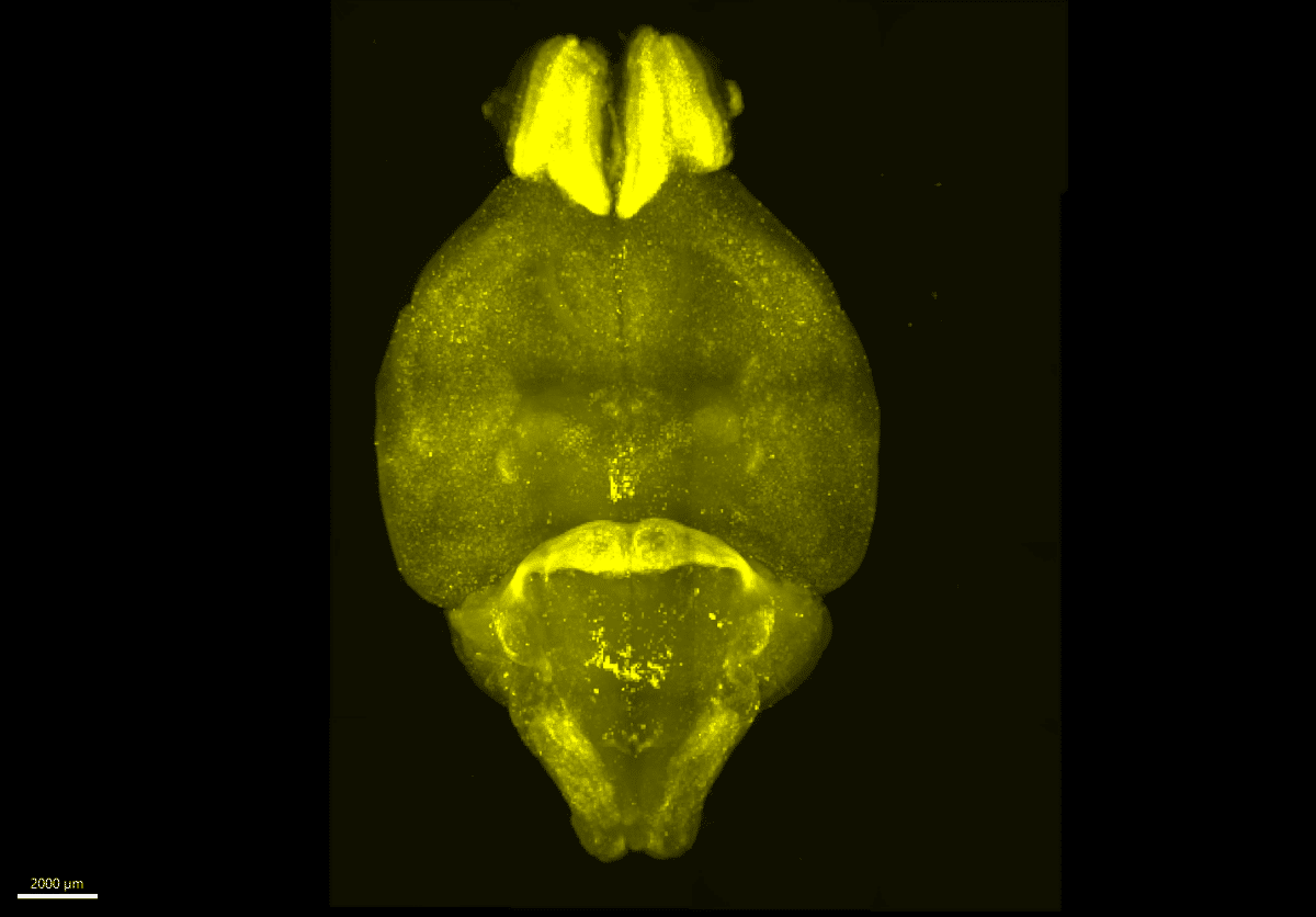 An international research team has revealed how brain activity shifts throughout the day by developing a method that can image which neurons and networks are active in mouse brains at different times.