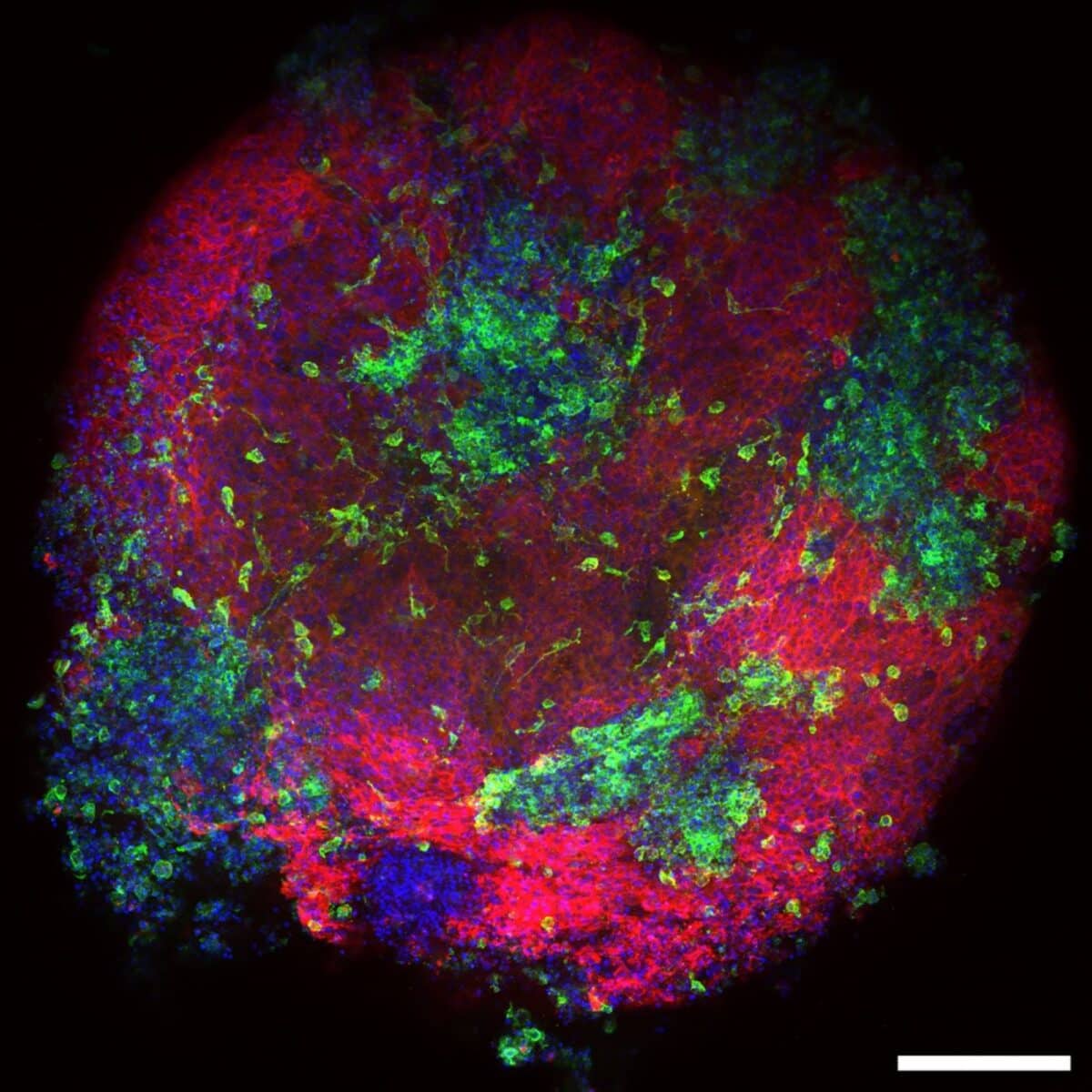 A culture dish full of macrophages using immunofluorescent microscopy imaging
