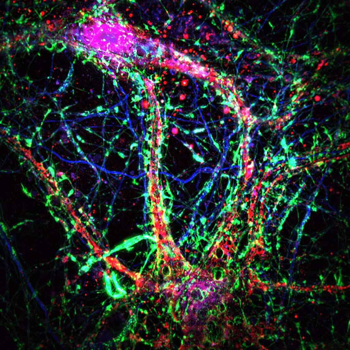 Scientists at Johns Hopkins Medicine say intercellular nanotubes (thin, green-dominant bridge-like connections) contribute to additional layer of communicational network among neurons.