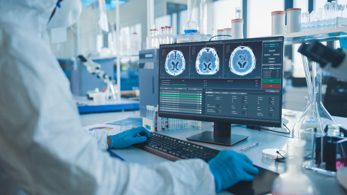 brain scan lab