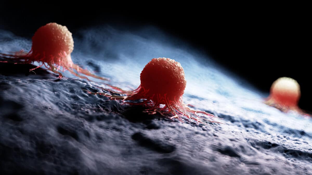 cancer cell