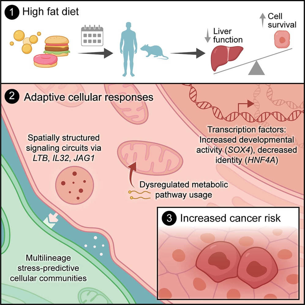 fatty diet and liver cancer