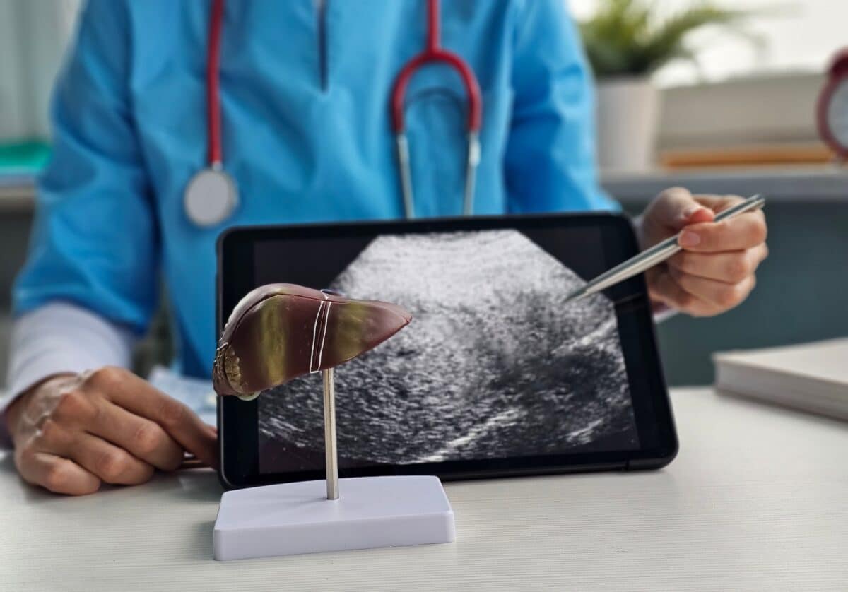 liver cancer