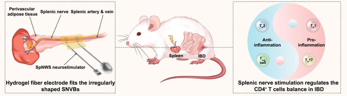 IBD implant