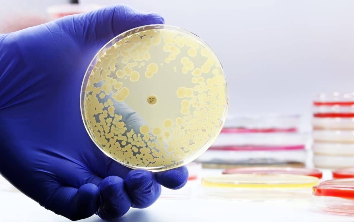 antibiotic-resistant petri dish