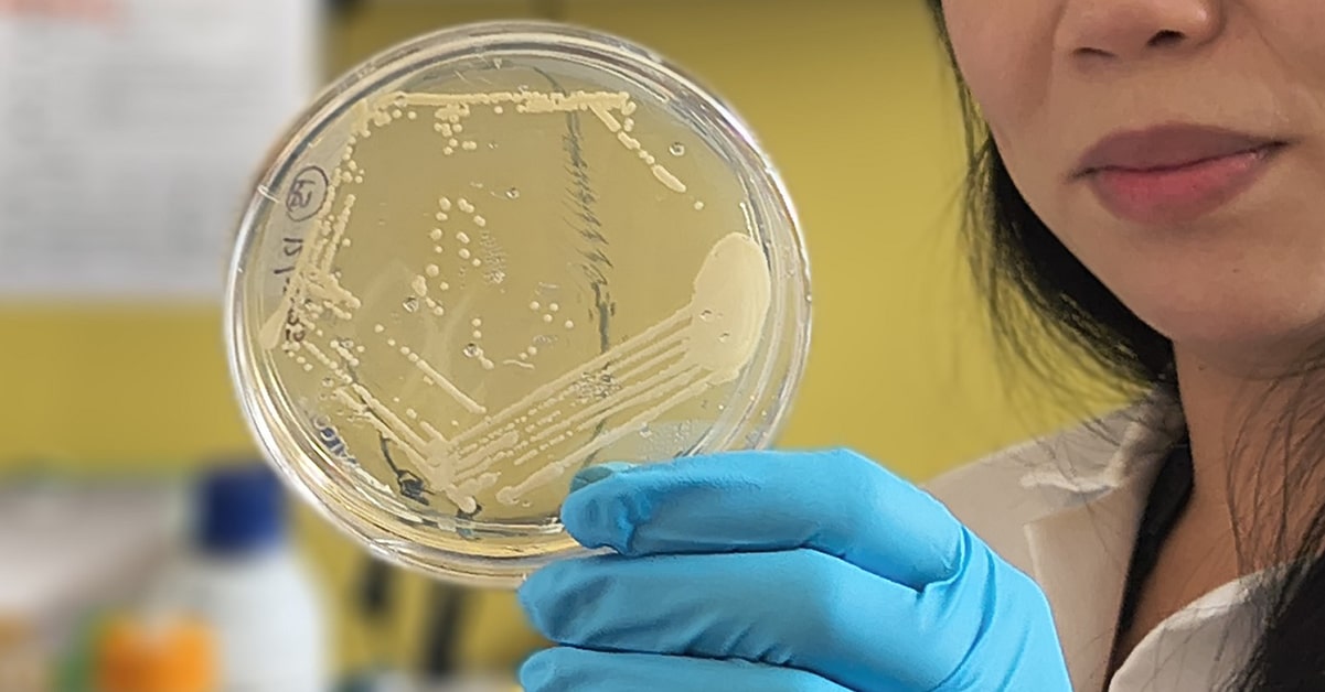 auto-brewery stool culture