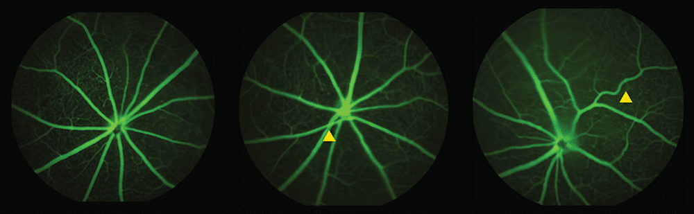 Retinal scans in mice
