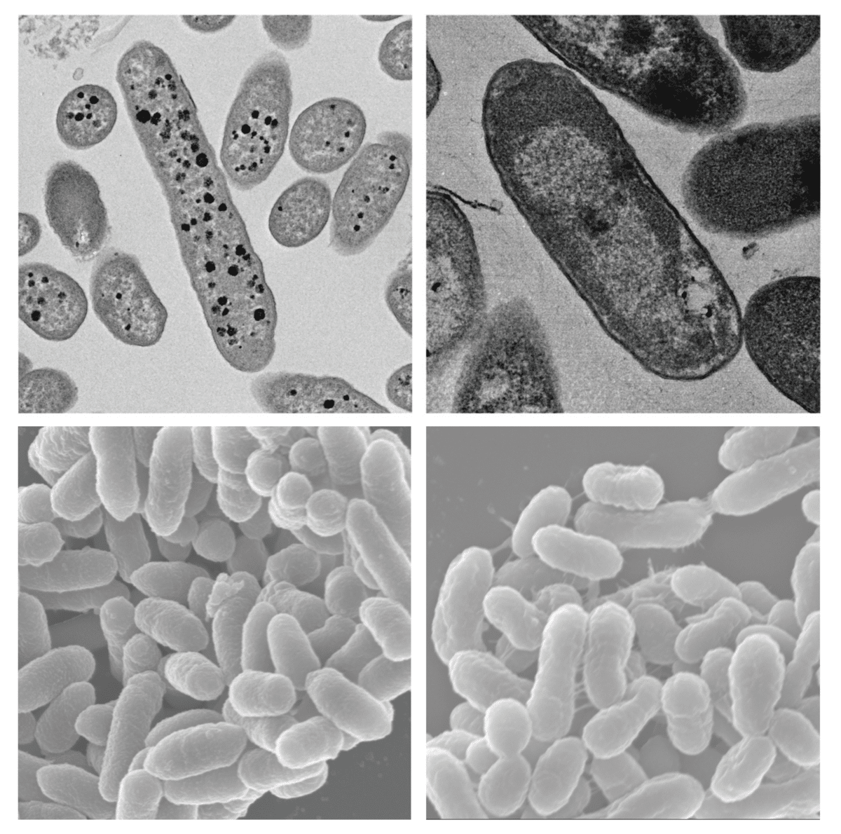 Bacterial constipation