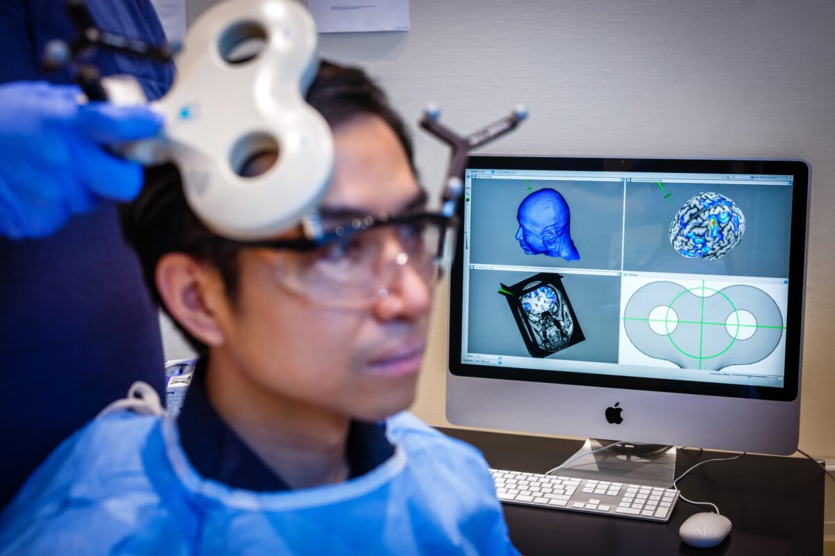 brain stimulation