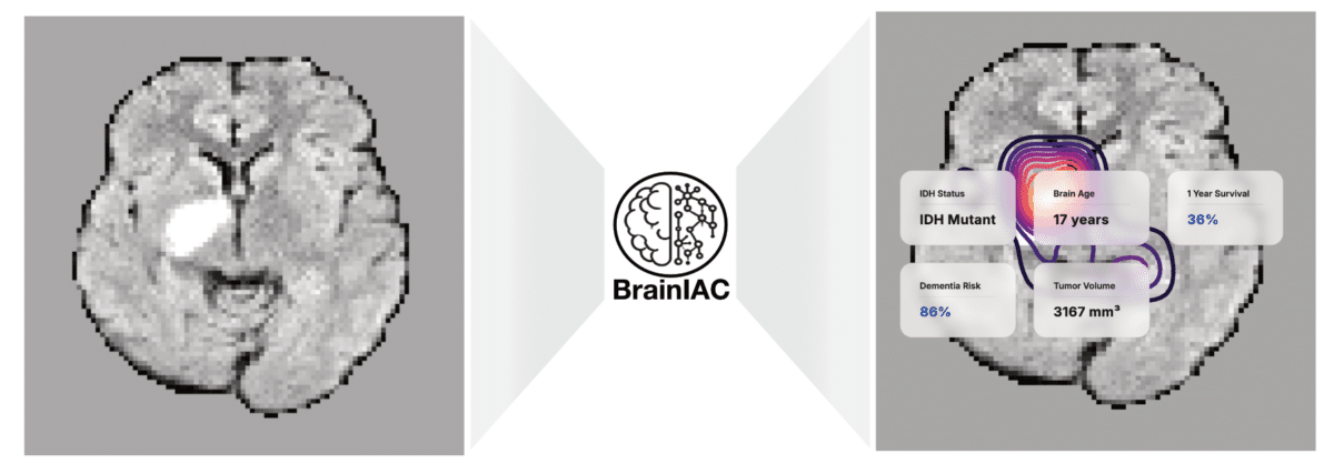 brainiac AI
