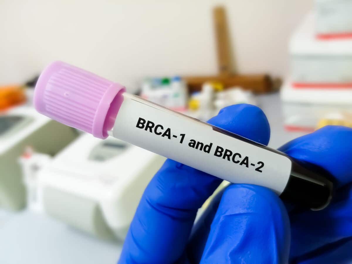 Blood test for BRCA1 and BRCA2 gene mutations