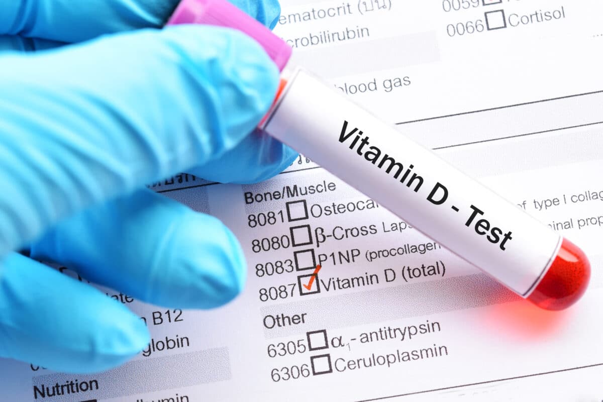 Vitamin D test tube