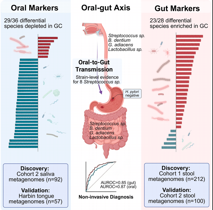 gastric cancer