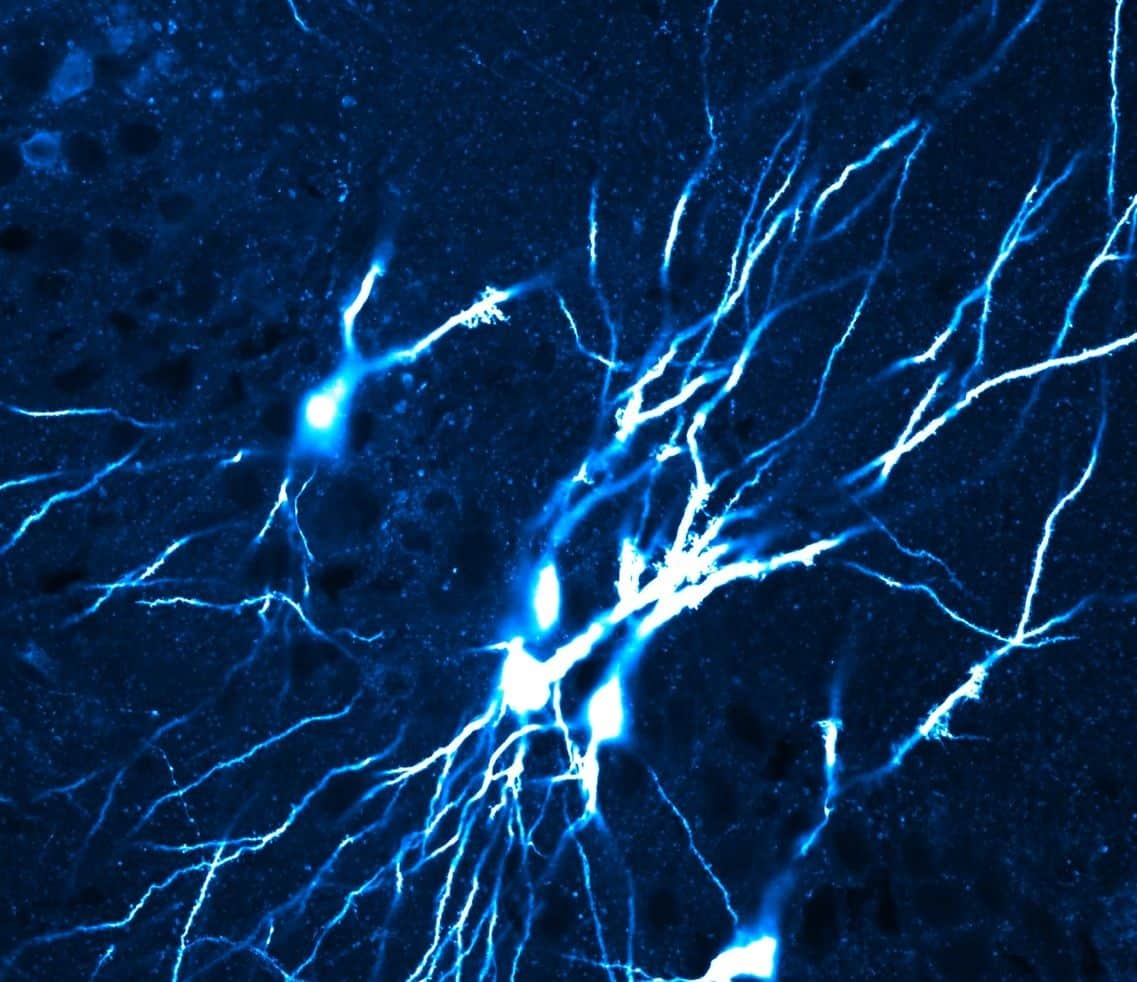 old mice neurons