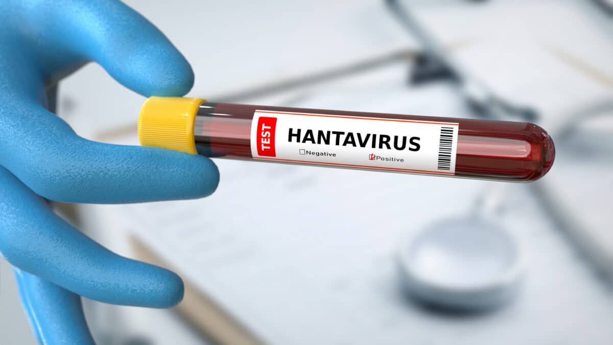 Hantavirus blood test
