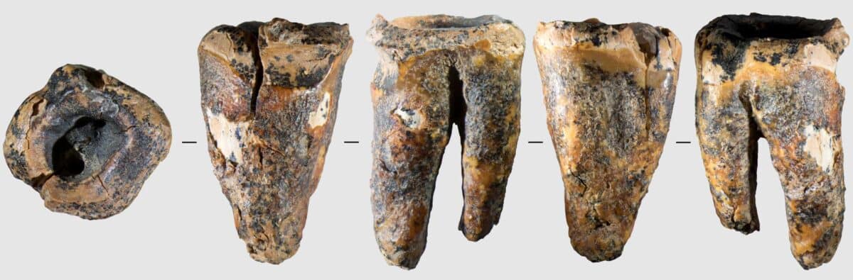 neanderthal teeth