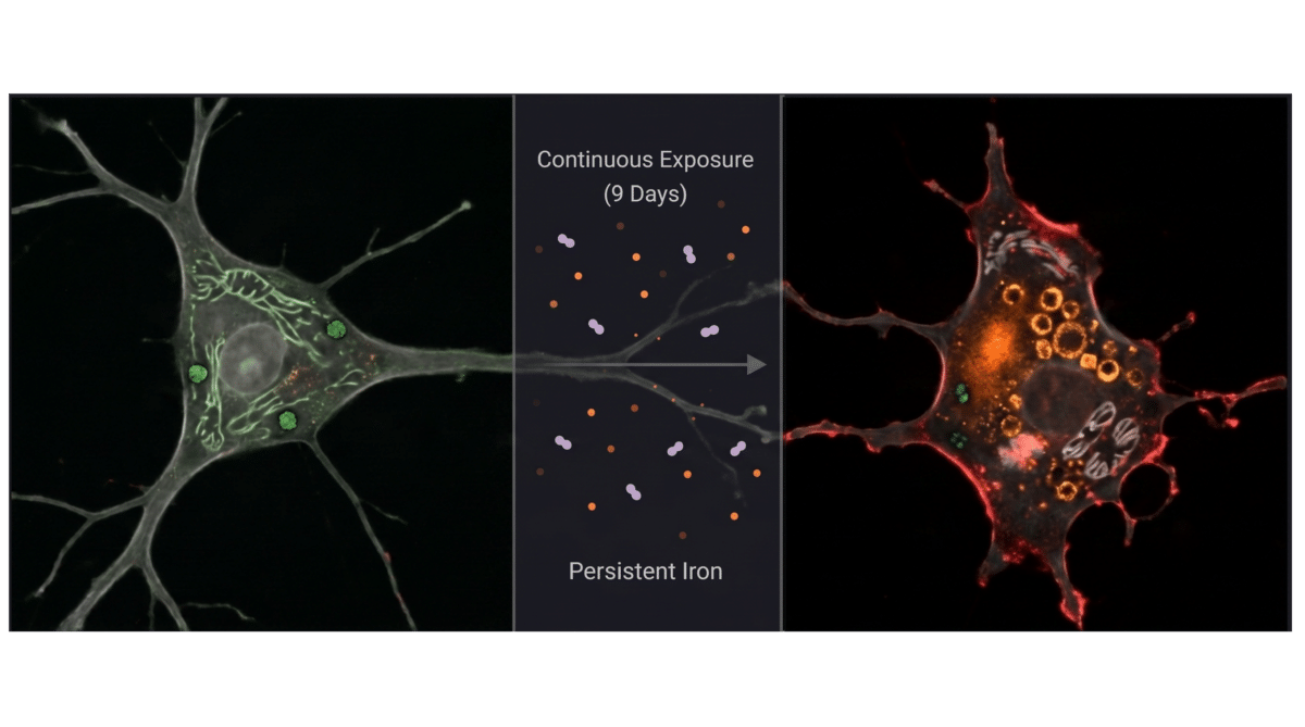 cell death iron