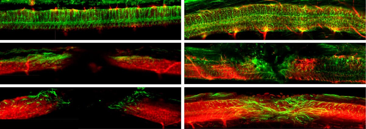 Microbots spinal cord study