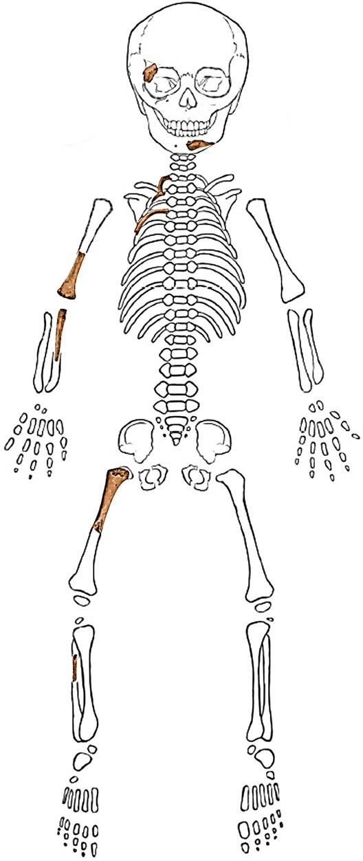 Combined images of the inventory of the fetal remains of neanderthal Sesselfelsgrotte 1