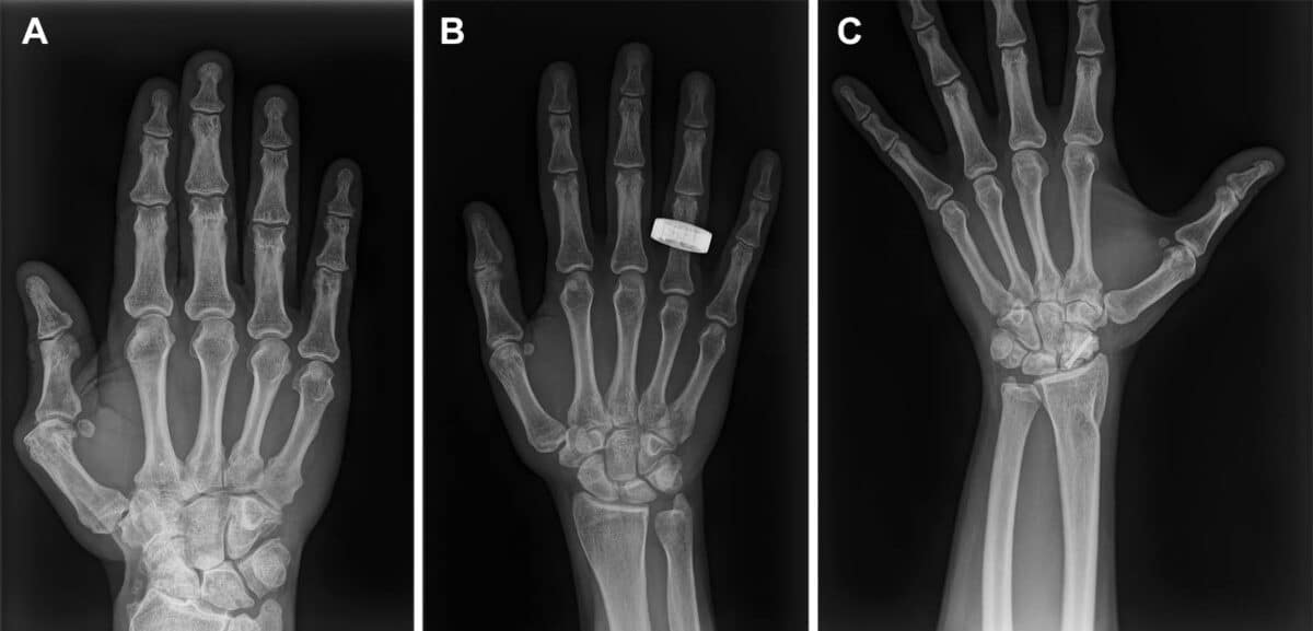 Space x-rays