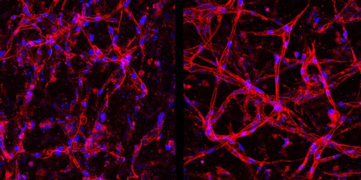 This red image depicts both healthy (right) and deteriorated (left) human retinal endothelial cells, which are essential for maintaining eye sight. The deterioration is caused by low oxygen and high glucose levels, mimicking conditions found in diabetic retinopathy, the leading cause of vision loss in working-age people in the United States.
