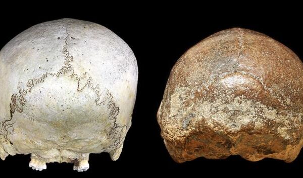 Back views of two skulls of a historical human (left) and a Homo erectus from Ngawi, Java (right: undated), exhibiting severe transverse deformational plagiocephaly.