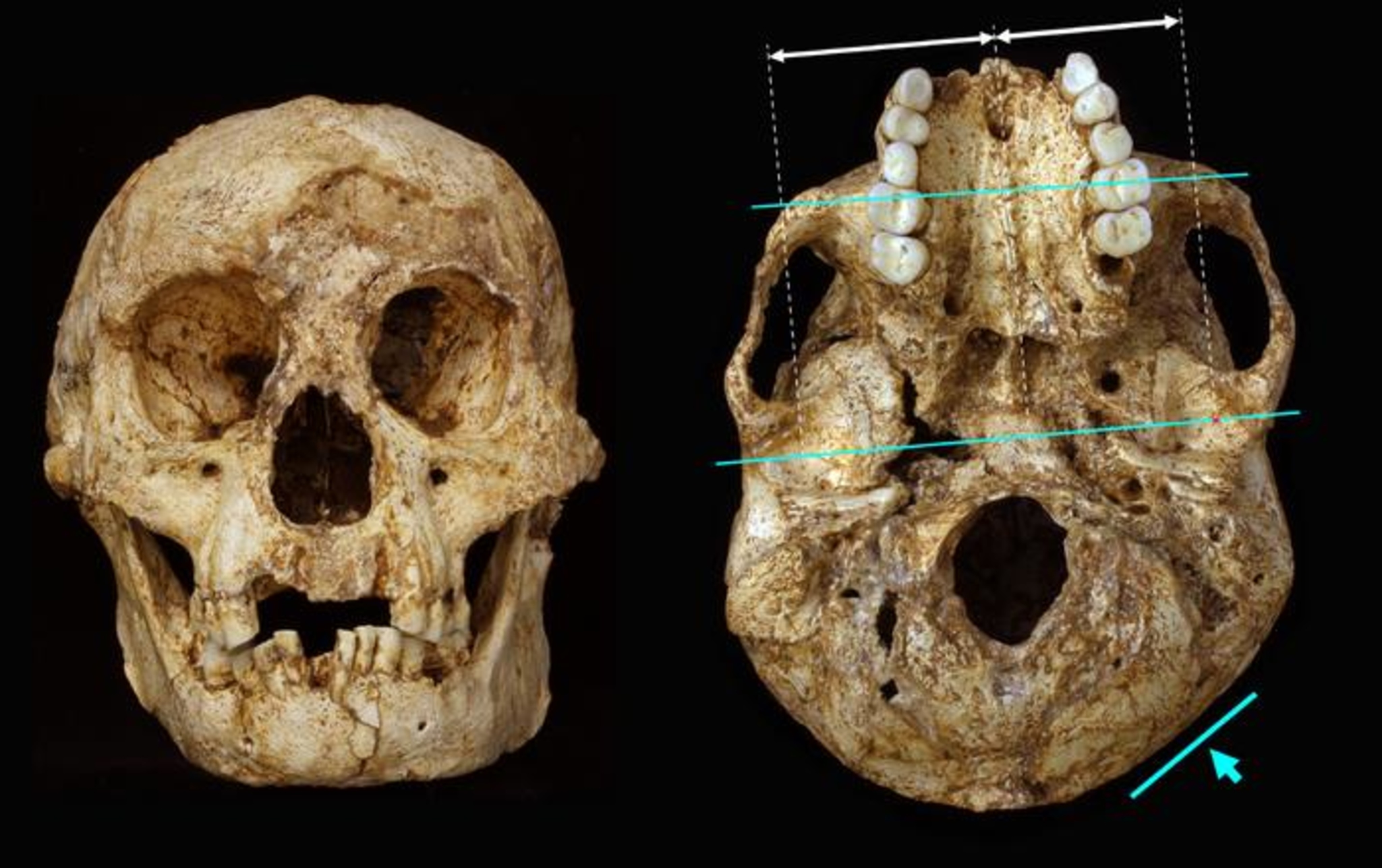 Ancient 'hobbit' skull examined in study