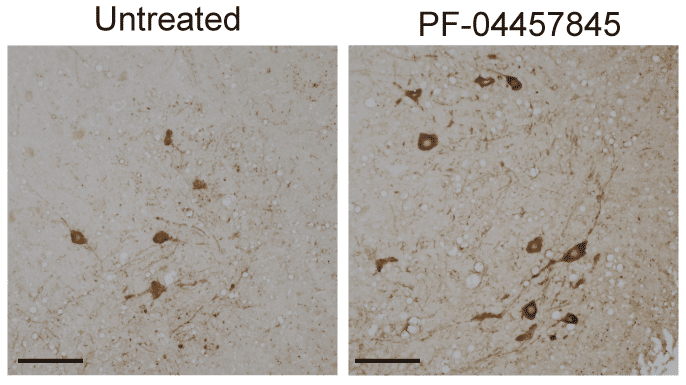 als motor neurons