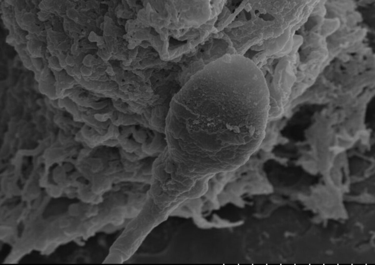 An Adelaide University study has found the navigational abilities of sperm are negatively impacted by a lack of gravity.