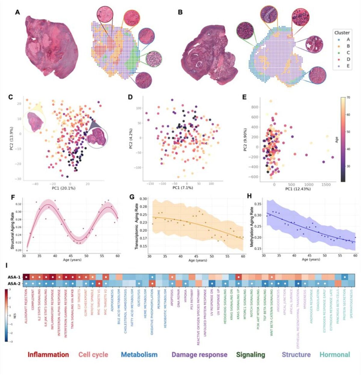 aging organs