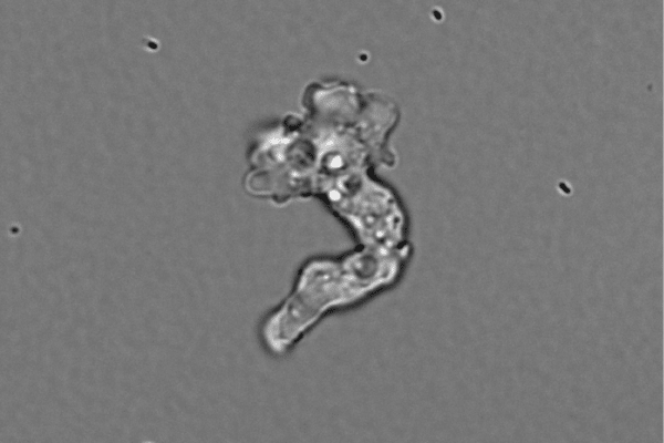 amoeba