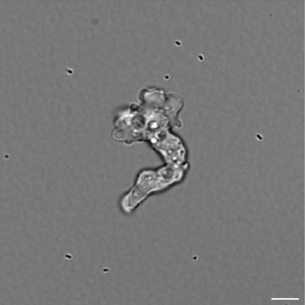 amoeba