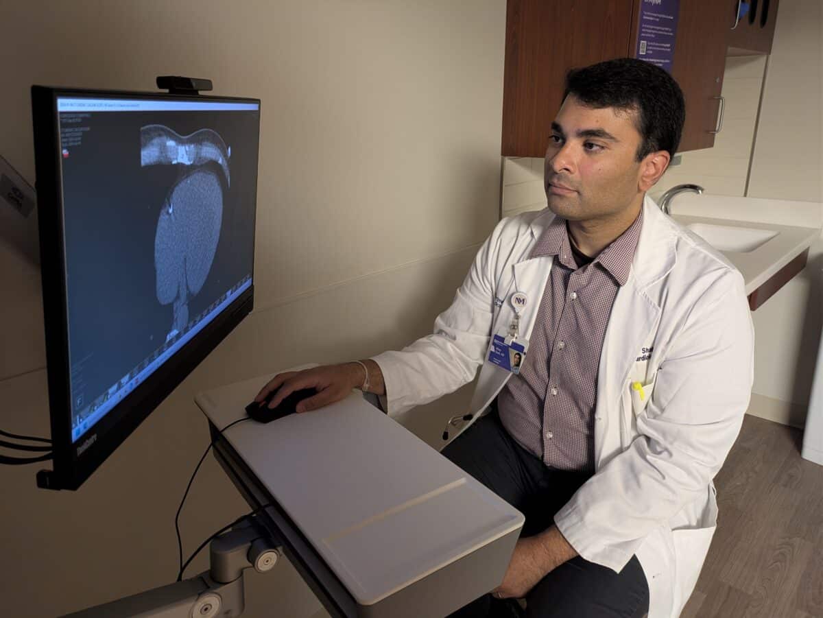 heart calcium scan