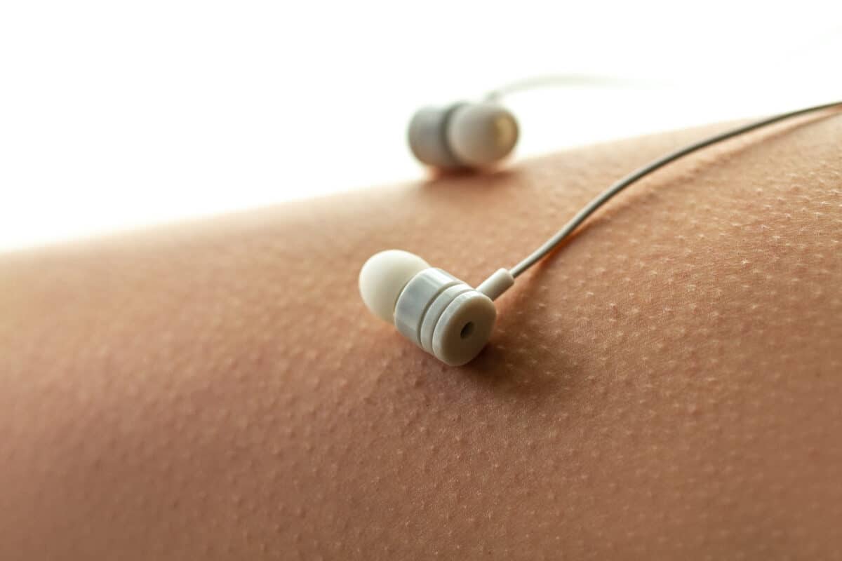 Person listening to music has the chills: earbuds are seen on top of an arm with goosebumps.
