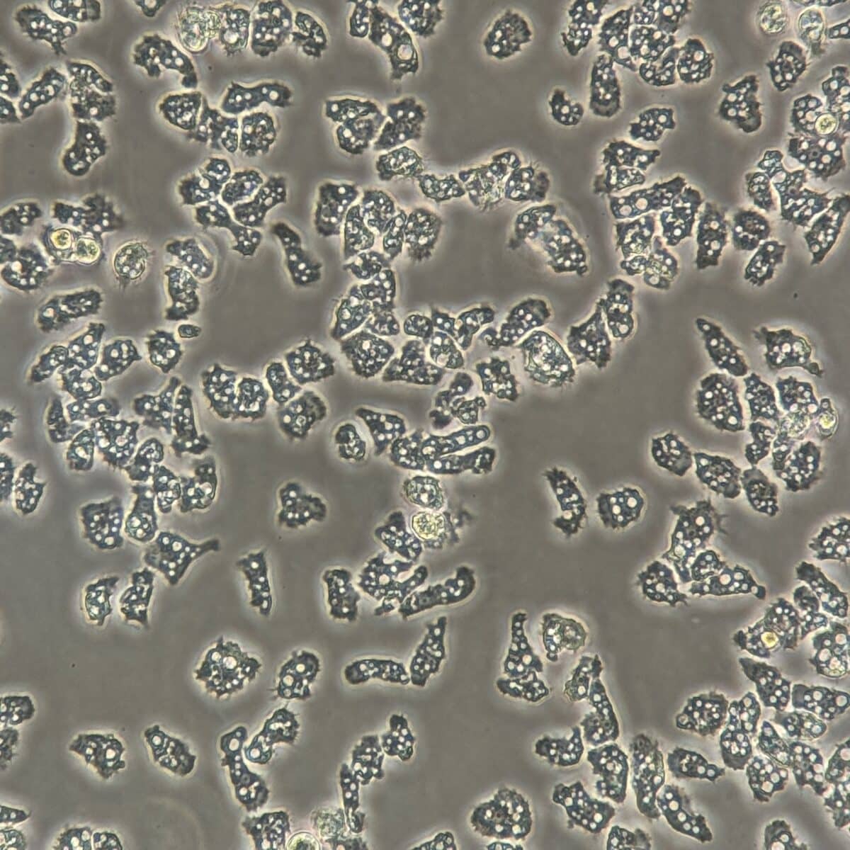 Acanthamoeba