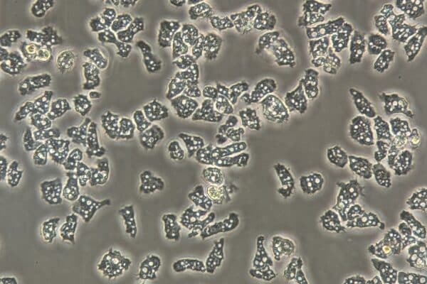Acanthamoeba